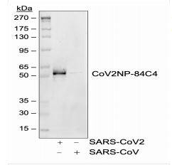 Western Blot: SARS-CoV-2 Nucleocapsid Antibody (84C4a) [NBP3-07041] - Western blot analysis of SARS-CoV2 and SARS-CoV nucleocapsid protein (50 ng) probed with 1 ug/mL CoV2NP rabbit monoclonal antibody (84C4a), CoV2NP-84C4.