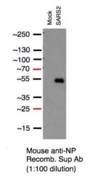 Western Blot: SARS-CoV-2 Nucleocapsid Antibody (1C7C7) - Azide and BSA Free [NBP3-07043] - Lysates were derived from A549 cells (Transduced with ACE2 by adenoviral vector), mock vs. SARS-CoV-2-infected MO12, 24 hours, with 60ug of lysates loaded/lane, Image Courtesy of Jeff Johnson Laboratory, ISMMS.