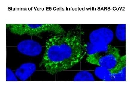 Immunocytochemistry/ Immunofluorescence: SARS-CoV-2 Nucleocapsid Antibody (1C7C7) - Azide and BSA Free [NBP3-07043] - Vero E6 infectedcwith SARS-CoV-2, Wa-1 @ MOI = 0.1 for 48 hours. Cells were fixed with 4 % formaldehyde (4hr), perm 0.1% Triton X (15min), blocked with 4 % BSA, 1:1000 diluted with clone 1C7C7 (Anti-SARS-CoV-2 Nucleocaspid) O/N tehn 1:1000 anti-mouse Dylight 488 (1 hour), Image Courtesy of Dr. Ana Fernandex - Sesma Laboratory, ISMMS.