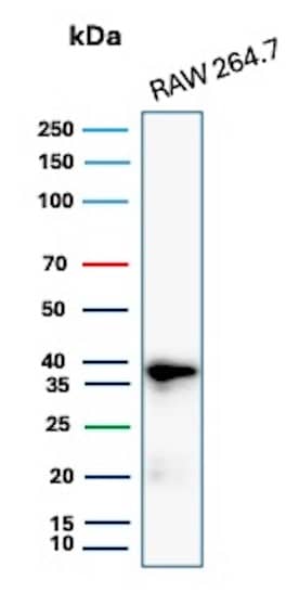 Western blot analysis of Raw264.7 cell lysate using Cyclin D1 Antibody (rCCND1/4752).