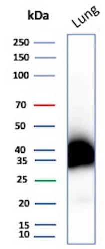 Western blot analysis of human Lung tissue lysate using Podoplanin Antibody (PDPN/4009R).