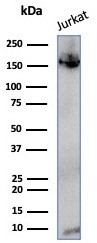 Western blot analysis of Jurkat cell lysate using TOP2A antibody (TOP2A/4397R).