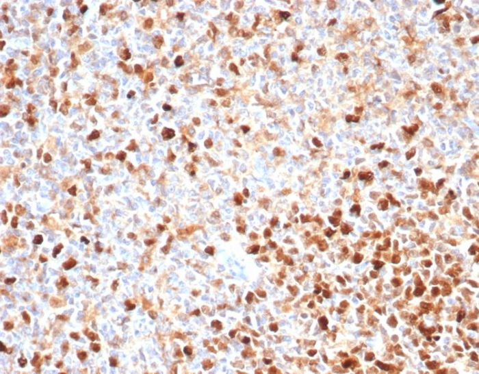 Formalin-fixed, paraffin-embedded human tonsil stained with TOP2A antibody (TOP2A/4397R).