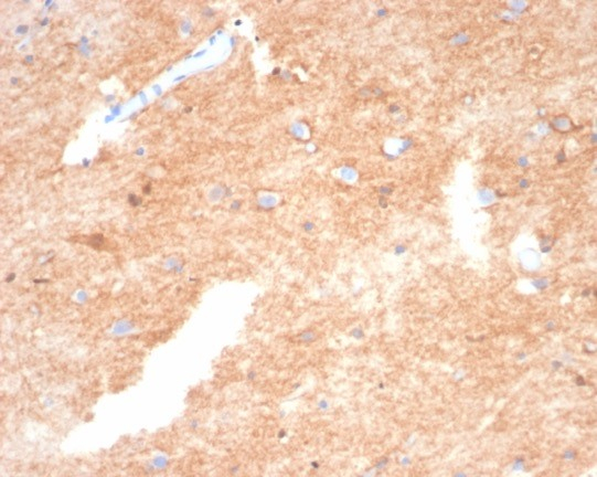 Formalin-fixed, paraffin-embedded dog brain stained with S100P antibody (S100P/4386R). HIER: Tris/EDTA, pH9.0, 45min. Secondary: HRP-polymer, 30min. DAB, 5min.