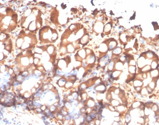 Formalin-fixed, paraffin-embedded cat colon stained with S100P antibody (S100P/4386R). HIER: Tris/EDTA, pH9.0, 45min. Secondary: HRP-polymer, 30min. DAB, 5min.