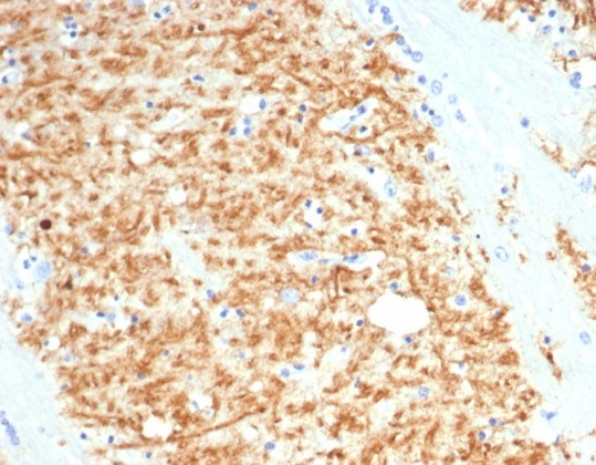 Formalin-fixed, paraffin-embedded cow brain stained with S100P antibody (S100P/4386R). HIER: Tris/EDTA, pH9.0, 45min. Secondary: HRP-polymer, 30min. DAB, 5min.