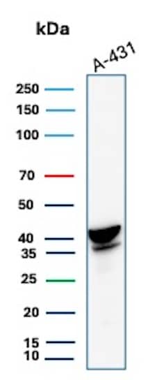Western Blot Analysis of A-431 lysate using Serpin B3/SCCA1 Antibody (CPTC-SERPINB3-2).
