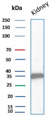 Western Blot Analysis of Human Kidney lysate using Napsin A Antibody (NAPSA/1865R)