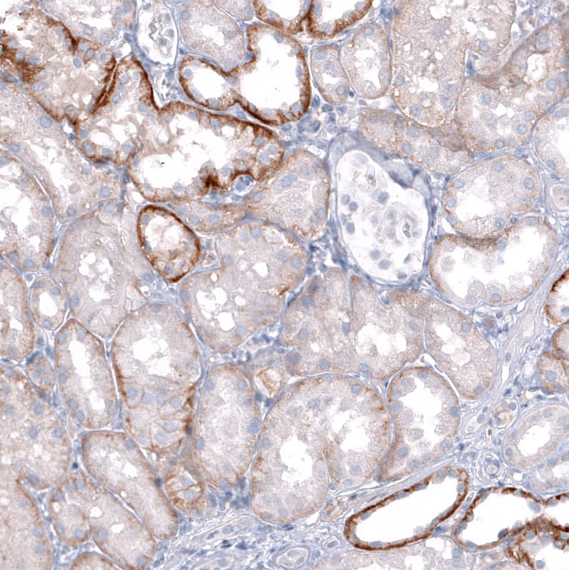 Immunohistochemistry-Paraffin TRPM4 Antibody (CL11214) - BSA Free