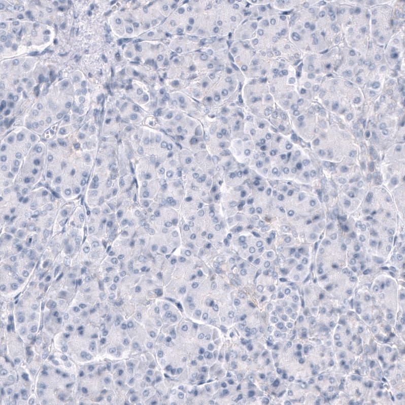 Immunohistochemistry-Paraffin TRPM4 Antibody (CL11214) - BSA Free
