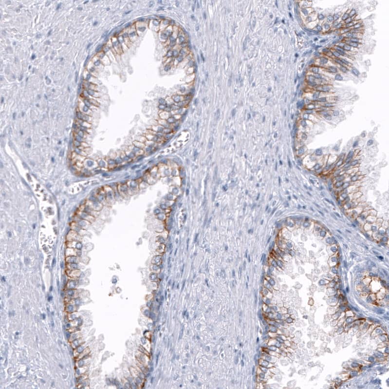 Immunohistochemistry-Paraffin TRPM4 Antibody (CL11214) - BSA Free