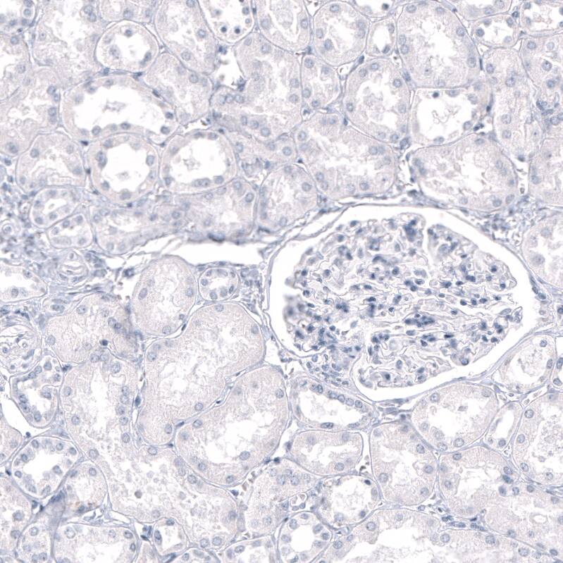 Staining of human kidney shows no positivity in cells in tubules as expected.