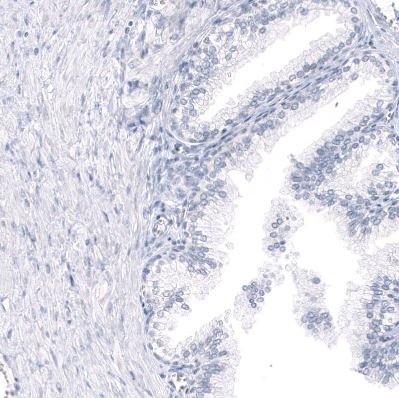 Staining of human prostate shows no positivity in glandular cells as expected.
