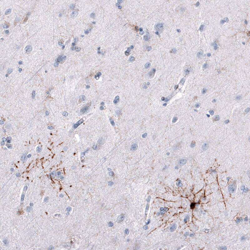 Staining of human cerebral cortex shows moderate cytoplasmic positivity in a subset of oligodendrocytes.