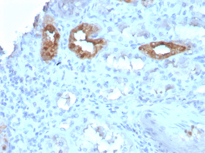 Formalin-fixed, paraffin-embedded human kidney stained with Calbindin D-28K antibody (CALB1/3333). HIER: Tris/EDTA, pH9.0, 45min. Secondary: HRP-polymer, 30min. DAB, 5min.