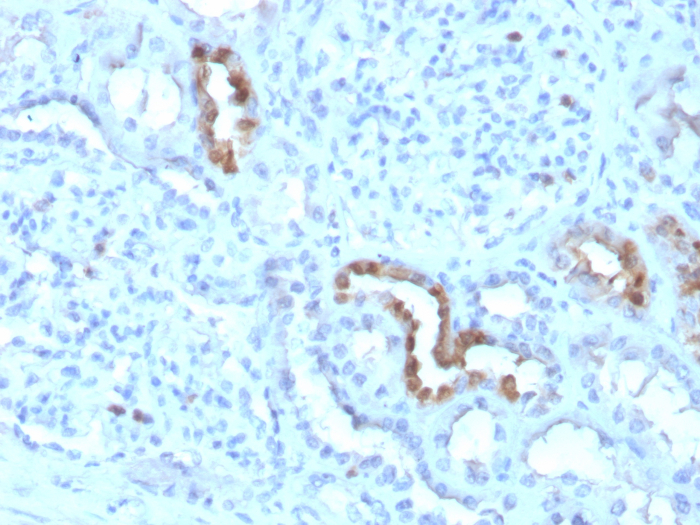 Formalin-fixed, paraffin-embedded human kidney stained with Calbindin D-28K antibody (CALB1/3333). HIER: Tris/EDTA, pH9.0, 45min. Secondary: HRP-polymer, 30min. DAB, 5min.