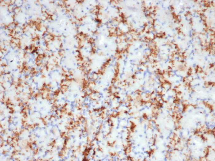 Formalin-fixed, paraffin-embedded human spleen stained with CD163 antibody (M130/3708R). HIER: Tris/EDTA, pH9.0, 45min. 2: HRP-polymer, 30min. DAB, 5min.