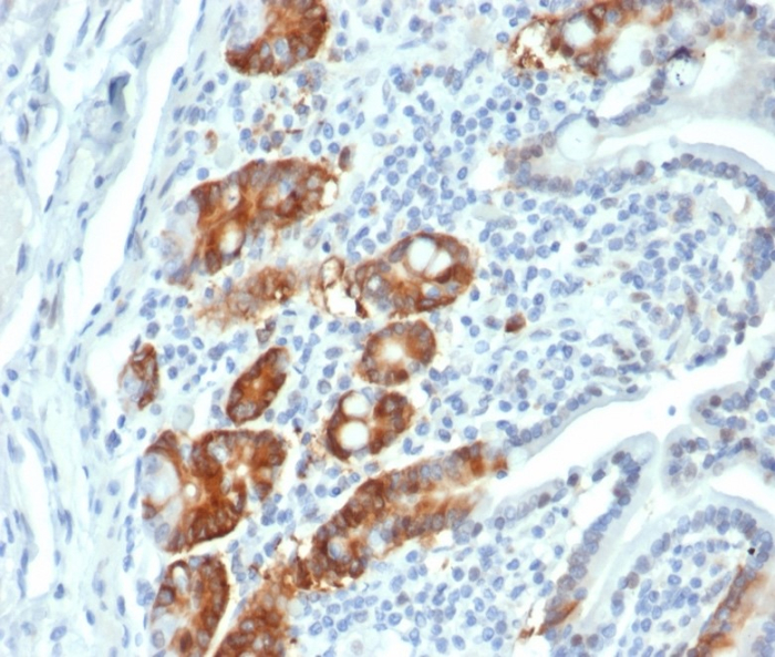 Formalin-fixed, paraffin-embedded human small intestine stained with RRM1 antibody (RRM1/4372R). HIER: Tris/EDTA, pH9.0, 45min. Secondary: HRP-polymer, 30min. DAB, 5min.