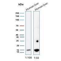 Western blot analysis of  human liver tissue lysates using G-CSF Antibody (CSF3/3166R) - Azide and BSA Free.