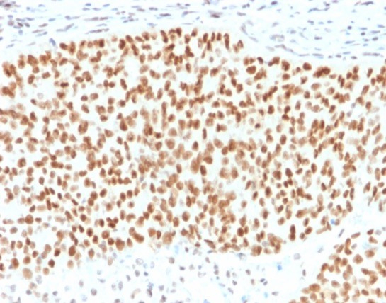 Formalin-fixed, paraffin-embedded human pancreas stained with SOX9 antibody (SOX9/2398). HIER: Tris/EDTA, pH9.0, 45min. Secondary: HRP-polymer, 30min. DAB, 5min.