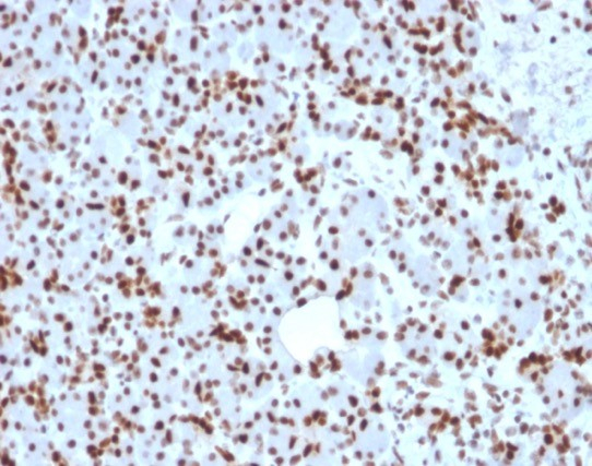 Formalin-fixed, paraffin-embedded human pancreas stained with SOX9 antibody (SOX9/2398). HIER: Tris/EDTA, pH9.0, 45min. Secondary: HRP-polymer, 30min. DAB, 5min.