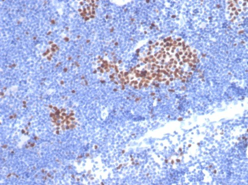 Formalin-fixed, paraffin-embedded cat lymph node stained with MCM7 antibody (MCM7/2832R). HIER: Tris/EDTA, pH9.0, 45min. Secondary: HRP-polymer, 30min. DAB, 5min.