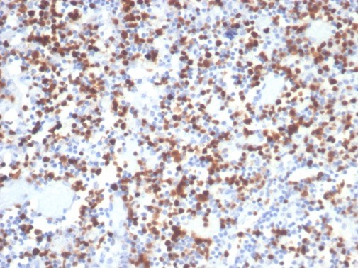 Formalin-fixed, paraffin-embedded dog lymph node stained with MCM7 antibody (MCM7/2832R). HIER: Tris/EDTA, pH9.0, 45min. Secondary: HRP-polymer, 30min. DAB, 5min.