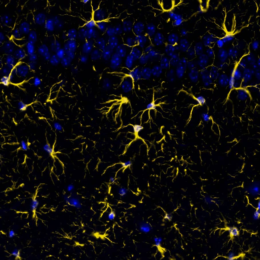 GFAP was detected in immersion fixed paraffin-embedded sections of mouse Brain Cortex using Rabbit Anti-Mouse GFAP Monoclonal Antibody at 0.15ug/mL at 37°Celsius for 2 minutes. Before incubation with the primary antibody, tissue underwent an all-in-one dewaxing and antigen retrieval preprocessing using PreTreatment Module (PT Module) and Dewax and HIER Buffer H (pH 9; Epredia Catalog # TA-999-DHBH). Tissue was stained using the Alexa Fluor™ Plus 555 Goat anti-Rabbit IgG Secondary Antibody at 1:100 at 37°Celsius for 2 minutes. (Yellow; Lunaphore Catalog # <A class=