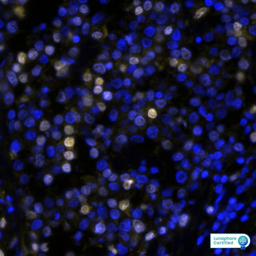 IRF4 was detected in immersion fixed paraffin-embedded sections of human Hodgkin's Lymphoma using Rabbit Anti-Human IRF4, Monoclonal Antibody at 10ug/mL at 37°Celsius for 4 minutes. Before incubation with the primary antibody, tissue underwent an all-in-one dewaxing and antigen retrieval preprocessing using PreTreatment Module (PT Module) and Dewax and HIER Buffer H (pH 9; Epredia Catalog # TA-999-DHBH). Tissue was stained using the Alexa Fluor™ Plus 647 Goat anti-Rabbit IgG Secondary Antibody at 1:200 at 37°Celsius for 2 minutes. (Yellow; Lunaphore Catalog # DR647RB) and counterstained with DAPI (blue; Lunaphore Catalog # DR100). Specific staining was localized to the nucleus. Protocol available in COMET™ Panel Builder.