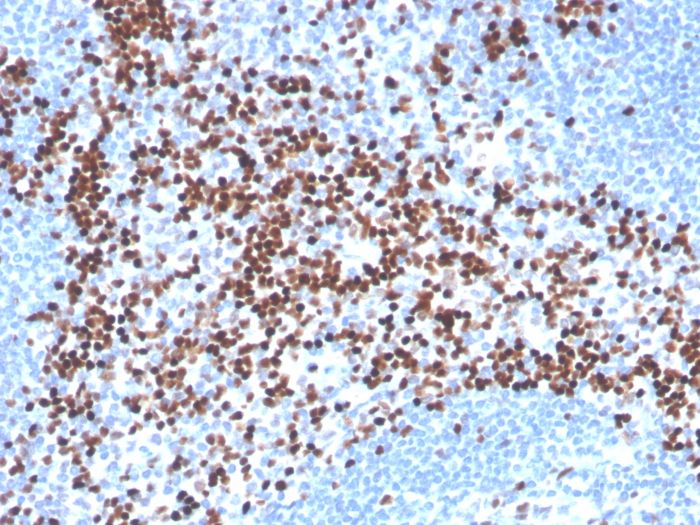 Formalin-fixed, paraffin-embedded analysis of human tonsil. Strong nuclear staining of non-germinal center cells using LEF1 antibody (LEF1/341R) at 2ug/ml in PBS for 30min RT. HIER: Tris/EDTA, pH9.0, 45min. Secondary: HRP-polymer, 30min. DAB, 5min.