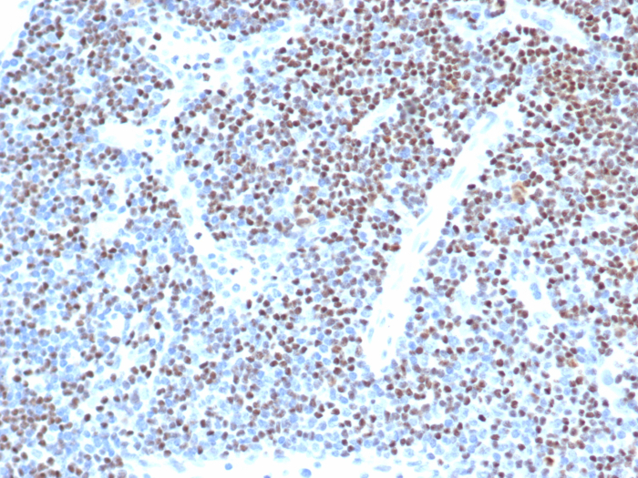 Formalin-fixed, paraffin-embedded analysis of human lymph node. Strong nuclear staining of non-germinal center cells using LEF1 antibody (LEF1/341R) at 2ug/ml in PBS for 30min RT. HIER: Tris/EDTA, pH9.0, 45min. Secondary: HRP-polymer, 30min. DAB, 5min.