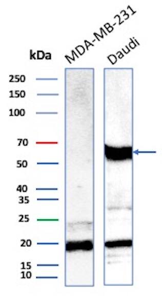 Western blot analysis of MDA-MB-231 and Daudi lysates using OGG1 Antibody (CPTC-OGG1-1) - Azide and BSA Free. 