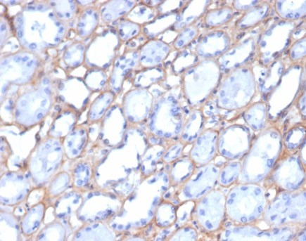 Formalin-fixed, paraffin-embedded human kidney stained with Collagen IV antibody (M3F7).