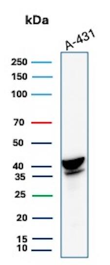 Western Blot Analysis of A-431 lysate using Serpin B3/SCCA1 Antibody (CPTC-SERPINB3-2) - Azide and BSA Free.
