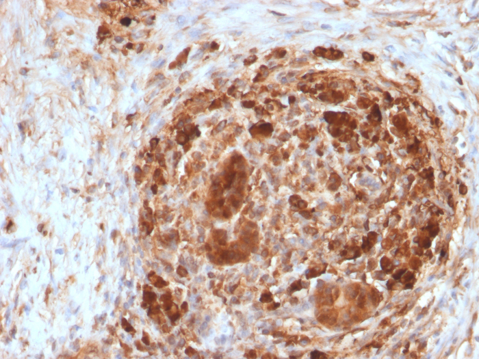 Formalin-fixed, paraffin-embedded human pancreas stained with Ferritin antibody (FTH/2082). HIER: Tris/EDTA, pH9.0, 45min. Secondary: HRP-polymer, 30min. DAB, 5min.