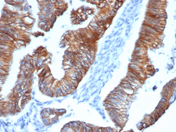 IHC analysis of formalin-fixed, paraffin-embedded human colon. p120-catenin antibody (CTNND1/4383R) at 2ug/ml in PBS for 30min RT. HIER: Tris/EDTA, pH9.0, 45min. Secondary: HRP-polymer, 30min. DAB, 5min.