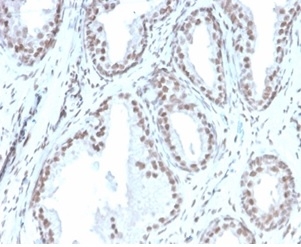 Formalin-fixed, paraffin-embedded human prostate stained with ATRX antibody (rATRX/3446).