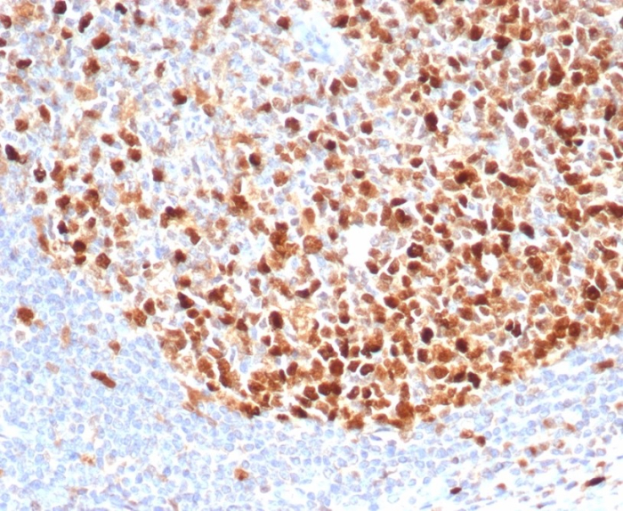 Formalin-fixed, paraffin-embedded human lymph node stained with TOP2A antibody (TOP2A/4397R). HIER: Tris/EDTA, pH9.0, 45min. Secondary: HRP-polymer, 30min. DAB, 5min.
