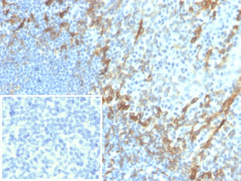 Formalin-fixed, paraffin-embedded human tonsil stained with Podoplanin antibody (PDPN/4009R). Inset: PBS instead of primary antibody; secondary only negative contro