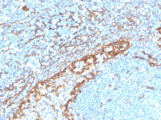 Formalin-fixed, paraffin-embedded human tonsil stained with Podoplanin antibody (PDPN/4009R). HIER: Tris/EDTA, pH9.0, 45min. Secondary: HRP-polymer, 30min. DAB, 5min.