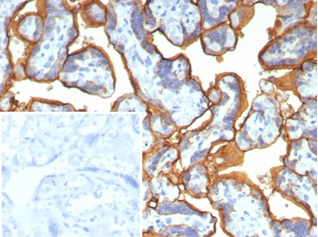 Formalin-fixed, paraffin-embedded human placenta stained with Alkaline Phosphatase/ALPP antibody (ALPP/2899R). Inset: PBS instead of primary antibody; secondary only negative control.