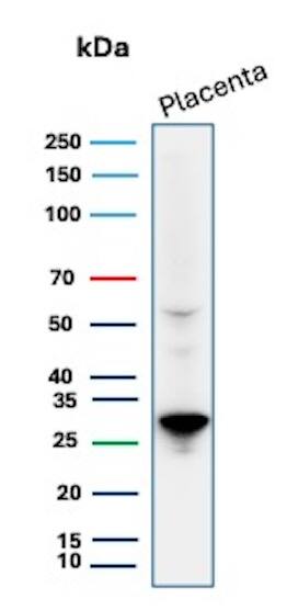 Western Blot Analysis of human placenta lysate using PDLIM1 Antibody (CPTC-PDLIM1-1) - Azide and BSA Free. (Expected Band size- 36 kDa; Observed Band size - 28 kDa)
