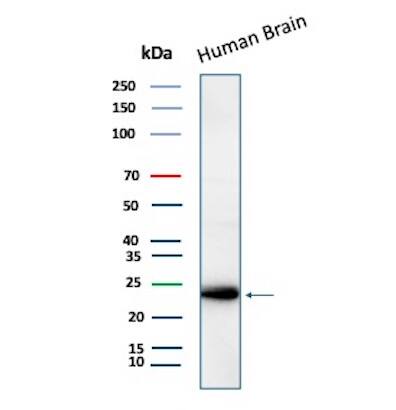 Western Blot Analysis of Human Brain tissue lysate using LMO2 Antibody (LMO2/3147R) - Azide and BSA Free.