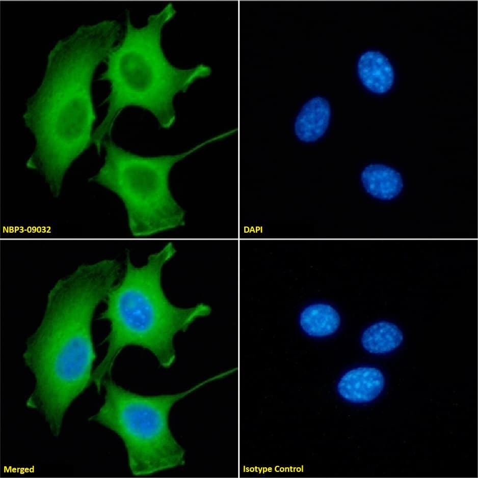 Immunocytochemistry /Immunofluorescence: Galectin-9 Antibody (RG9-35) - Chimeric - Azide and BSA Free [NBP3-09032] - Immunofluorescence analysis of paraformaldehyde fixed RAW264.7 cells on Shi-fix(TM) coverslips stained with NBP3-09032 at 10 ug/ml for 1h followed by Alexa Fluor(R) 488 secondary antibody (2 ug/ml), showing membrane staining. The nuclear stain is DAPI (blue). Panels show from left-right, top-bottom: NBP3-09032, DAPI, merged channels and an isotype control. The isotype control was an unknown specificity antibody followed by staining with Alexa Fluor(R) 488 secondary antibody.