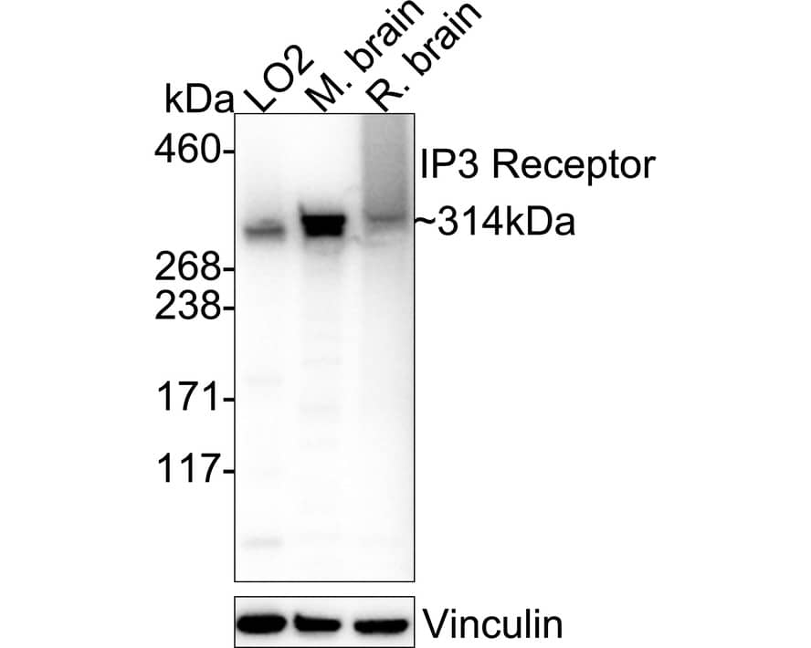 Western blot analysis on different lysates with NBP3-09066 at 1/5,000 dilution. Lane 1: LO2 cell lysate (20 µg/Lane) Lane 2: Mouse brain tissue lysate (20 µg/Lane) Lane 3: Rat brain tissue lysate (20 µg/Lane) Predicted band size: 314 kDa Observed band size: 314 kDa Exposure time: 4 seconds;  4-20% SDS-PAGE gel. Proteins were transferred to a PVDF membrane and blocked with 5% NFDM/TBST for 1 hour at room temperature. NBP3-09066 at 1/5,000 dilution was used in primary antibody dilution at 4℃ overnight. Goat Anti-Rabbit IgG [HRP] Secondary Antibody at 1/50,000 dilution was used for 1 hour at room temperature.