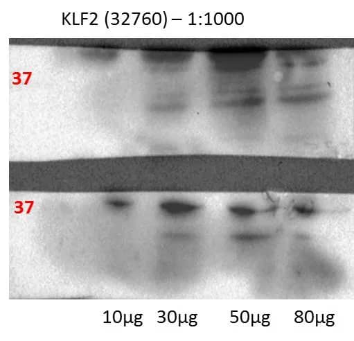 Human lung cell line