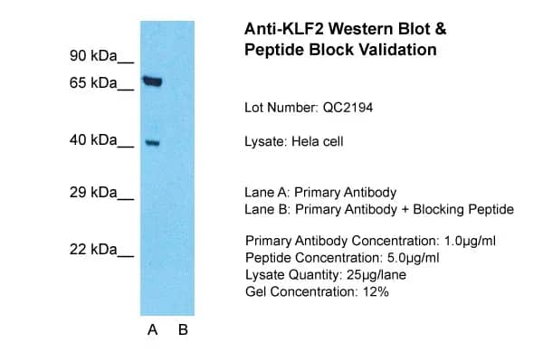 Host: RabbitTarget Name: KLF2Sample Type: Hela Whole cellLane A: Primary AntibodyLane B: Primary Antibody + Blocking PeptidePrimary Antibody Concentration: 1ug/mlPeptide Concentration: 5ug/mlLysate Quantity: 25ug/laneGel Concentration: 0.12%