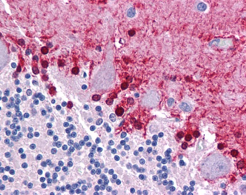 Immunohistochemistry with Human brain, cerebellum