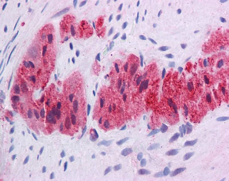 Immunohistochemistry with Human Colon, myenteric plexus