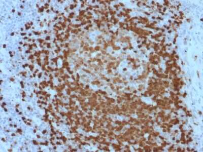 Immunohistochemistry-Paraffin: TCL1A Antibody (TCL1/2079) - Azide and BSA Free [NBP3-11312] - Formalin-fixed, paraffin-embedded human Lymph Node stained with TCL1A Mouse Monoclonal Antibody (TCL1A/2079).